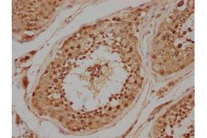 IHC image of ABIN7146598 diluted at 1:200 and staining in paraffin-embedded human testis tissue performed on a Leica BondTM system.