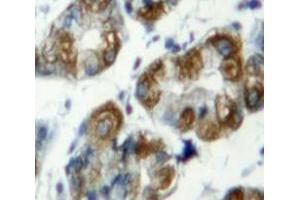 Used in DAB staining on fromalin fixed paraffin-embedded Stomach tissue (TLR7 抗体  (AA 887-1036))