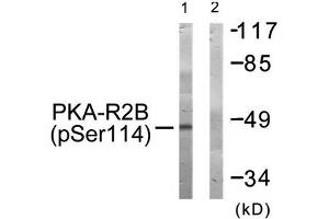Western blot analysis of extracts from COS-7 cells treated with PMA using PKA-R2β (Phospho-Ser114) Antibody. (PRKAR2B 抗体  (pSer113))