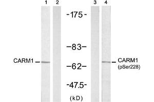 Western blot analysis of extracts from A431 cells untreated or treated with EGF (200 ng/mL, 5 min), using CARM1 (Ab-228) antibody (Line 1 and 2) and CARM1 (Phospho-Ser228) antibody (Line 3 and 4). (CARM1 抗体  (pSer228))