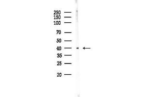 Western blot analysis of lysates from COLO205 cells, using OR5P2 Antibody at 1/1000 dilution.