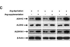 Arg supplementation activates ethanol degradation pathways in HepG2 cells. (ADH1C 抗体  (AA 1-375))