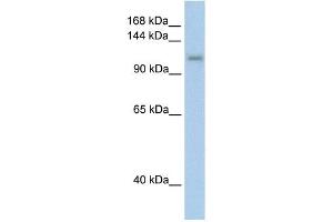 WB Suggested Anti-PRPF6 Antibody Titration:  2. (PRP6/ANT-1 抗体  (C-Term))