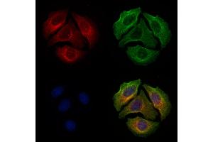 ABIN6255799 and ABIN6277803 staining Hela cells(4h of LPS treatment) by IF/ICC. (ERBB3 抗体  (pTyr1289))