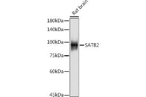 Western blot analysis of extracts of Rat brain, using S antibody (ABIN7270152) at 1:500 dilution. (SATB2 抗体)