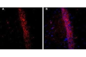 Expression of KCNQ2 in rat brain - Immunohistochemical staining of free-floating frozen rat hippocampal CA1 region sections using Guinea pig Anti-KCNQ2 Antibody (ABIN7043504, ABIN7045416 and ABIN7045417), (1:200).