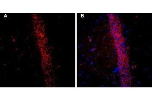Expression of KCNQ2 in rat brain - Immunohistochemical staining of free-floating frozen rat hippocampal CA1 region sections using Guinea pig Anti-KCNQ2 Antibody (ABIN7043504, ABIN7045416 and ABIN7045417), (1:200). (KCNQ2 抗体  (C-Term, Intracellular))
