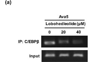 Chromatin Immunoprecipitation (ChIP) image for anti-CCAAT/enhancer Binding Protein (C/EBP), beta (CEBPB) (N-Term) antibody (ABIN2854833)
