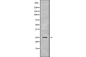 Western blot analysis of PSMD9 using HepG2 whole cell lysates (PSMD9 抗体  (N-Term))