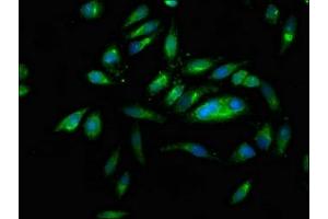 Immunofluorescence staining of Hela cells with ABIN7161406 at 1:166, counter-stained with DAPI. (PNPLA6 抗体  (AA 345-493))
