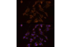 Immunofluorescence analysis of PC-12 cells using PFKFB3 Rabbit mAb (ABIN1680620, ABIN3018306, ABIN3018307 and ABIN7101590) at dilution of 1:100 (40x lens). (PFKFB3 抗体)