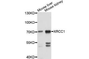 Western blot analysis of extracts of mouse liver and mouse kindney cells, using XRCC1 antibody.