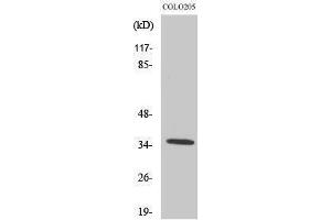 Western Blotting (WB) image for anti-Olfactory Receptor, Family 52, Subfamily D, Member 1 (OR52D1) (C-Term) antibody (ABIN3186129) (OR52D1 抗体  (C-Term))