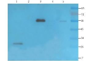 Western Blot using anti-VEGF antibody  Rat thyroid (lane 1), rat bladder (lane 2), mouse brain (lane 3), human thyroid cancer (lane 4) and human ovarian cancer (lane 5) samples were resolved on a 12% SDS PAGE gel and blots probed with  at 2 µg/ml before being detected by a secondary antibody. (Recombinant VEGF 抗体)