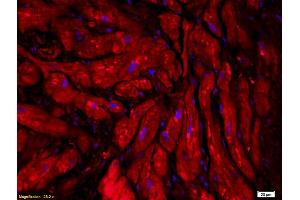 Formalin-fixed and paraffin embedded human myocardial tissue labeled with Anti-CT-1/CTF1 Polyclonal Antibody, Unconjugated (ABIN741675) followed by conjugation to the secondary antibody (Cardiotrophin 1 抗体  (AA 121-201))