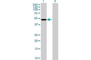 Western Blot analysis of ARMC6 expression in transfected 293T cell line by ARMC6 MaxPab polyclonal antibody. (ARMC6 抗体  (AA 1-476))