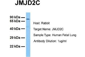 Host: Rabbit Target Name: JMJD2C Sample Tissue: Human Fetal Lung Antibody Dilution: 1. (KDM4C 抗体  (C-Term))