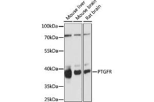 Western blot analysis of extracts of various cell lines, using PTGFR antibody (ABIN7269574) at 1:1000 dilution. (PTGFR 抗体  (AA 50-150))