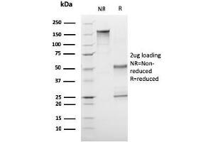 SDS-PAGE Analysis Purified CD1a Mouse Monoclonal Antibody (C1A/3249). (CD1a 抗体  (AA 43-173))