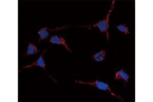 Immunofluorescence analysis of anti-ALDH1A1 antibody and HeLa cells.