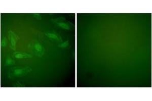 Immunofluorescence analysis of HeLa cells, using DJ-1 Antibody. (PARK7/DJ1 抗体  (AA 21-70))