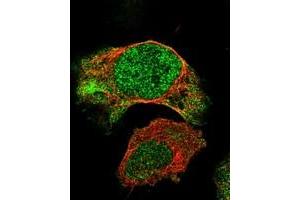 Immunofluorescent staining of human cell line U-2 OS with BNC2 polyclonal antibody  at 1-4 ug/mL dilution shows positivity in nucleus and cytoplasm. (Basonuclin 2 抗体)
