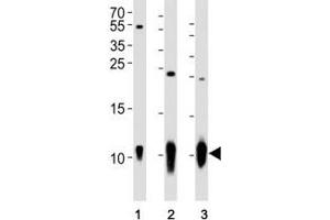 Western blot analysis of lysate from (1) A431 cell line, (2) mouse brain and (3) rat brain tissue using S100B antibody at 1:1000. (S100B 抗体)