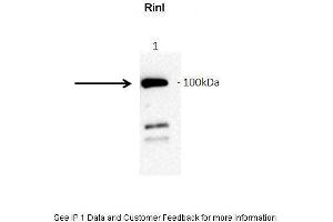 Amount and Sample Type : GFP-hRinl transfected COS7 cell lysate Amount of IP Antibody : 10ug Primary Antibody : anti-GFP Primary Antibody Dilution : 1:1000 Secondary Antibody : Goat anti-rabbit-HRP Secondary Antibody Dilution : 1:5000 Gene Name : RINL Submitted by : Barbara Woller; Medical University of Vienna (RINL 抗体  (N-Term))