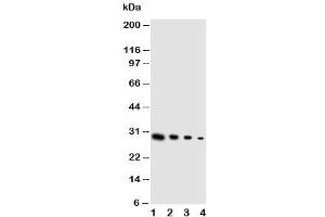 Western blot testing of GDNF antibody and Lane 1:  recombinant human protein 10ng (GDNF 抗体  (Middle Region))