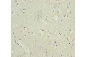 Immunohistochemistry of paraffin-embedded human brain tissue using ABIN7164067 at dilution of 1:100 (POU4F3 抗体  (AA 1-180))
