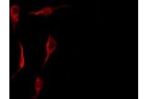 ABIN6278289 staining HepG2 by IF/ICC.