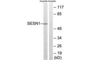Western blot analysis of extracts from rat muscle cells, using SESN1 Antibody. (SESN1 抗体  (AA 271-320))