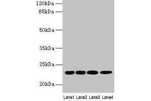 Western blot All lanes: CBX5 antibody at 9 μg/mL Lane 1: K562 whole cell lysate Lane 2: MCF-7 whole cell lysate Lane 3: 293T whole cell lysate Lane 4: Hela whole cell lysate Secondary Goat polyclonal to rabbit IgG at 1/10000 dilution Predicted band size: 23 kDa Observed band size: 23 kDa (CBX5 抗体  (AA 1-191))