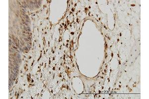 Immunoperoxidase of monoclonal antibody to B2M on formalin-fixed paraffin-embedded human esophagus. (beta-2 Microglobulin 抗体  (AA 1-119))