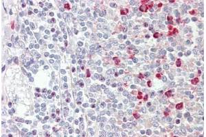 anti-Guanine Nucleotide Binding Protein (G Protein), Q Polypeptide (GNAQ) (AA 45-348) antibody