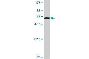 Western Blot detection against Immunogen (52. (HIV-1 Tat Interactive Protein 2, 30kDa (HTATIP2) (AA 1-242) 抗体)