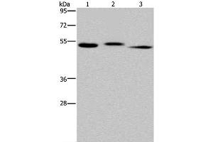 Western Blot analysis of Human kidney tissue, HepG2 cell and Human testis tissue using HYAL3 Polyclonal Antibody at dilution of 1:400 (HYAL3 抗体)