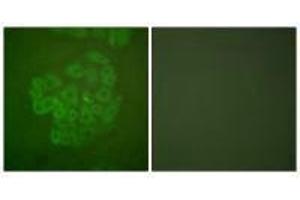 Immunofluorescence analysis of A549 cells, using GR (Ab-211) antibody. (Glucocorticoid Receptor 抗体  (Ser211))