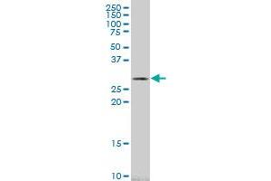 CA1 monoclonal antibody (M10), clone 1F1. (CA1 抗体  (AA 1-261))