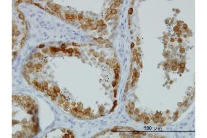 Immunoperoxidase of monoclonal antibody to DAZ1 on formalin-fixed paraffin-embedded human testis.