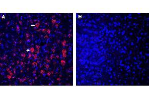 Expression of CD157 in rat parietal cortex. (BST1 抗体  (Extracellular))