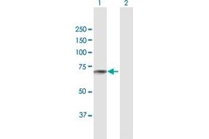 Western Blotting (WB) image for anti-Transforming Growth Factor, beta-Induced, 68kDa (TGFBI) (AA 1-683) antibody (ABIN948553)