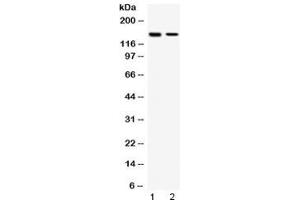 Western blot testing of human 1) HeLa and 2) MCF7 cell lysate with SAFB antibody at 0. (SAFB 抗体  (AA 715-754))