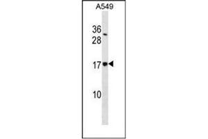 Western blot analysis of SSR4 / TRAPD Antibody  in A549 cell line lysates (35ug/lane). (SSR4 抗体  (Middle Region))