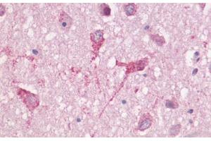 Anti-GPR83 antibody  ABIN1048881 IHC staining of human brain, neurons and neuropil. (GPR83 抗体  (Cytoplasmic Domain))