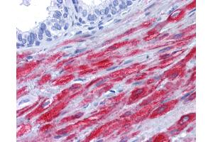 Anti-SMTN / Smoothelin antibody IHC of human prostate.