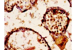 Immunohistochemistry (IHC) image for anti-Sodium Channel, Voltage-Gated, Type IX, alpha Subunit (SCN9A) (AA 1849-1988) antibody (ABIN7169929)