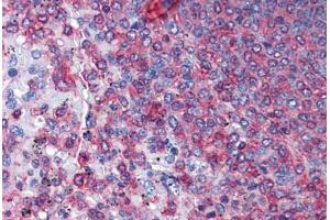 Human Spleen: Formalin-Fixed, Paraffin-Embedded (FFPE) (Actin, gamma 1 抗体  (AA 1-119))