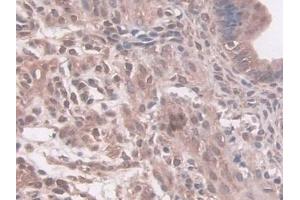 Detection of NAT1 in Mouse Uterus Tissue using Polyclonal Antibody to N-Acetyltransferase 1 (NAT1) (NAT1 抗体  (AA 9-254))
