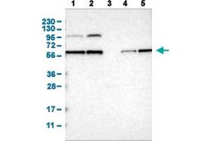 Western Blot analysis of (1) human cell line RT-4 (2) human cell line U-251MG sp (3) human plasma (IgG/HSA depleted) (4) human liver tissue, and (5) human tonsil tissue. (PPM1B 抗体  (AA 359-463))